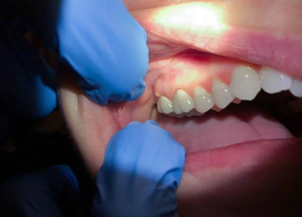 Best Pediatric Emergency Dentist in Flourtown, PA