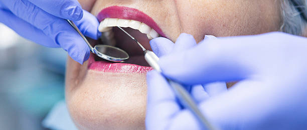 Best Broken or Cracked Tooth Emergency Dentist in Flourtown, PA
